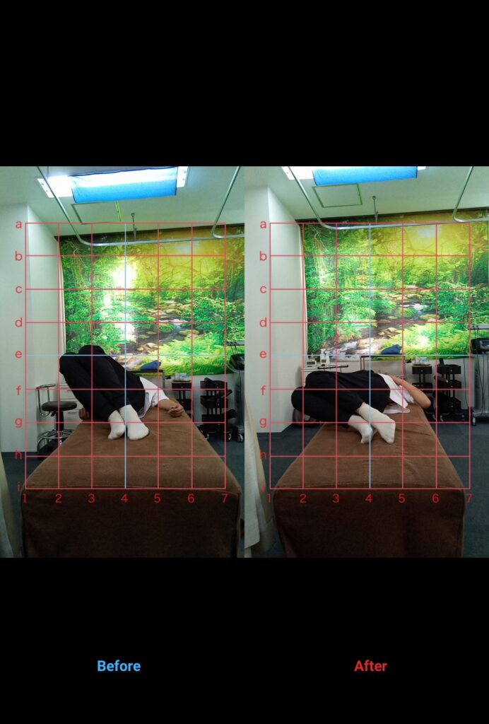 あなたは体の不調、我慢していませんか?     50代女性・会社員•腰•足の裏の違和感が気になる方のビフォーアフターをご紹介します!