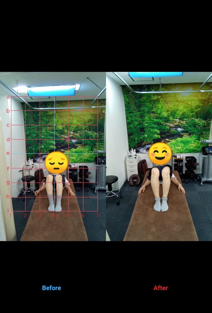 あなたは体の不調、我慢していませんか?     50代女性・パート•仕事中や歩くとき右背中に痛みがある方のビフォーアフターをご紹介します!