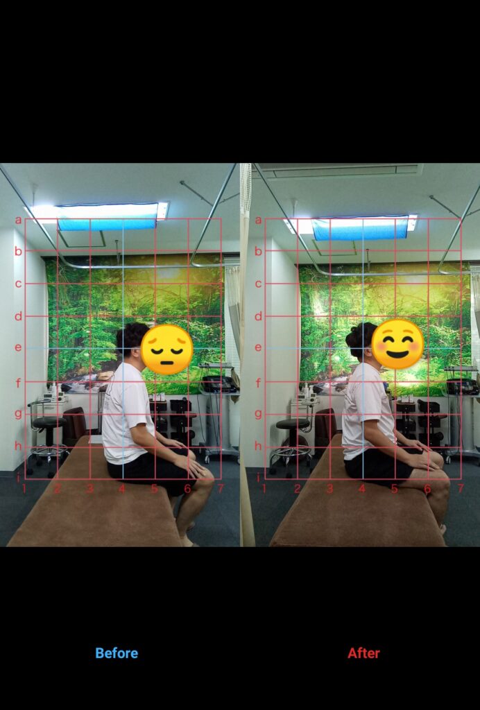 あなたは体の不調、我慢していませんか?  50代男性・会社員•仕事中に座っていると首•肩•背中が痛くなってくる方のビフォーアフターをご紹介します!