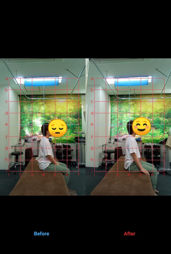 あなたは体の不調、我慢していませんか?     40代女性・会社員•仕事中に座っていると首•肩•腰が痛くなってくる方のビフォーアフターをご紹介します!