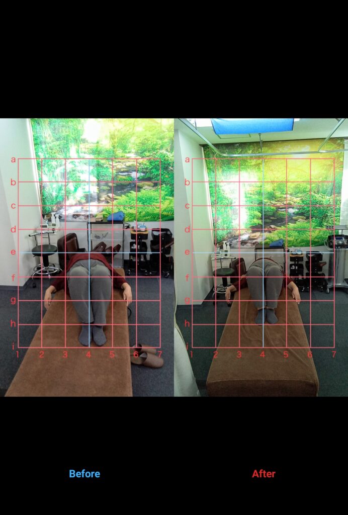 あなたは体の不調、我慢していませんか?     70代女性・主婦•仰向けに寝ると首•肩•背中•腰が痛くなるの方のビフォーアフターをご紹介します!